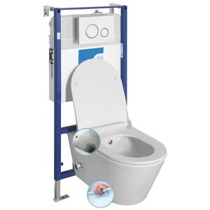 SAPHO Závěsné WC AVVA CLEANWASH , integr. baterie a bidet. sprška s podomítkovou nádržkou a tlačítkem Schwab, bílá 100315-SET5 obraz